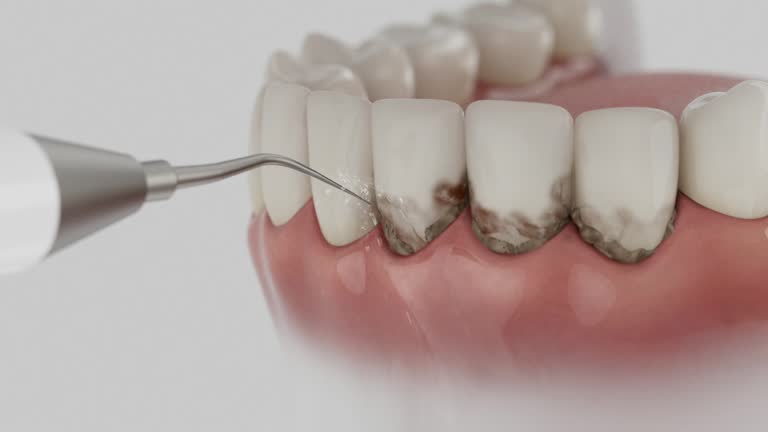 Trusted Teeth Whitening service in Clarksville, VA - Dentist Open Now